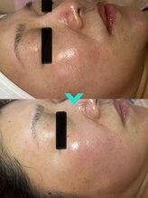 ミルキー(Milky)/くすみを取って明るい肌へ