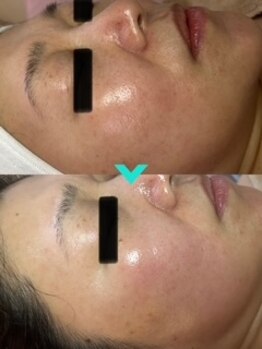 ミルキー(Milky)/くすみを取って明るい肌へ