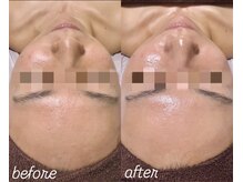 アンベリール(Embellir)/Embellir