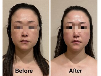 ムーロ バイ ミュー(muro. by mieux)/コルギ