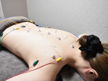 ドリームスタイル 川崎駅前(Dream Style)の写真/[駅近/個室]一流女性鍼灸師が最適施術で根本改善★鍼灸/美顔鍼/整体etc男女,ペアOK!疲労改善&美肌&小顔も◎