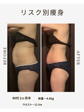 ビーシェイプ 君津(B-Shape)/【痩身】ビフォーアフター