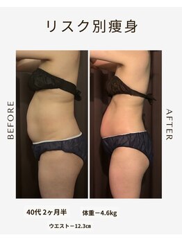 ビーシェイプ 君津(B-Shape)/【痩身】ビフォーアフター