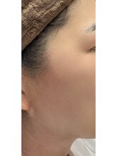 エヌフェイシャル(N.facial)/卒業♪