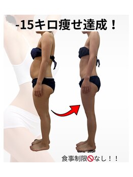 リヴェーヌ 呉羽店(Riverne)の写真/筋膜リリースでガツンと！痩身マシンでセル脂肪分解・脂肪術を組み合わせでナイスボディへ◎