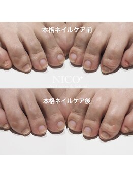 ニコプラス(NICO+)/足のお手入れできていますか?