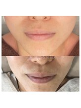 エクラ(eclat)/タラソトリートメント／継続