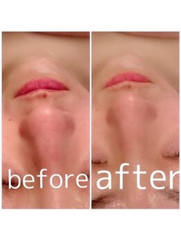 アンリール 苫小牧店(ANRIRE)/フェイシャル施術のお客様です