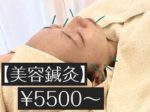 アカシア鍼灸整骨院の雰囲気（【美容鍼灸】痛みの少ない鍼と顔専用のお灸で施術）