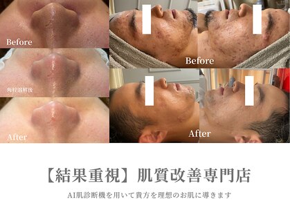 カルナ(CARNA)の写真