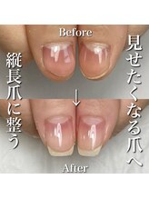 リリー/変形爪もしっかり整う◎