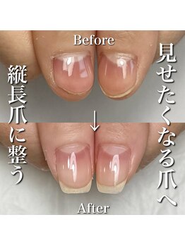 リリー/変形爪もしっかり整う◎