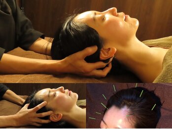 モミーズ(momii's)の写真/【頭皮鍼&眠れるあたまほぐし】頭の疲れを癒す極上の癒し時間をご提供◎頭
皮鍼×指圧で相乗効果抜群♪