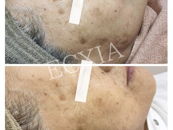 エクシア(ECXIA)/