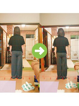 サプライズ整体院/30代ママさんの産後の骨盤初回