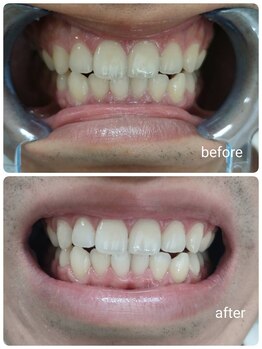 ルルネイル(Lulu Nail)/月一万円で通い放題