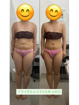 メリアミーゴ(Meli amigo)の写真/【福島市初】エステ業界で話題の≪痩身×最新筋膜リリース≫導入!くびれ作り/美脚/痩身効果/30分￥2200