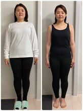 ベルネージュ 千葉山王店(Belle Neige)/【耳つぼ】40代3ヶ月－9.9ｋｇ