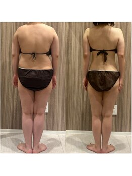 フルリールボーテ(Fleurir Beaut)の写真/骨格を整える施術で美ラインを追求。筋膜リリースで歪みを改善するボディメイク★