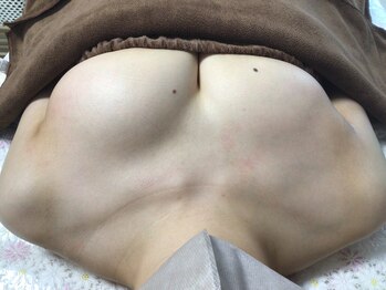 マイントゥー(mine too)/むっちりデコルテ☆