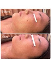 サロンジー(Salon Gee)/☆もちろん美肌叶えます☆