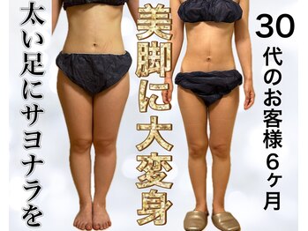 サロン ド ボーテ ラーンジュ 岐阜店(salon de beaut'e L'ange)/ハイパ-ナイフEX2ダイエット痩身