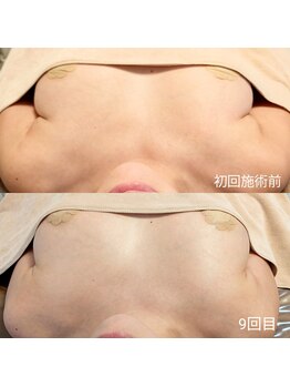 アンドボディ 横浜元町(&Body)/30代後半 バストアップ