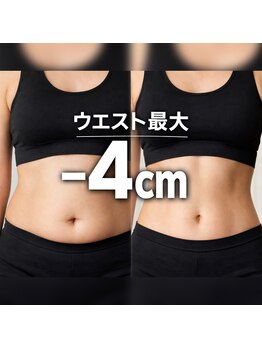 ソワン ド ブランシュ ライフ八戸ノ里店(Soin de Blanche)の写真/【全国に数台だけ】22000円→9800円脂肪の層を測定！