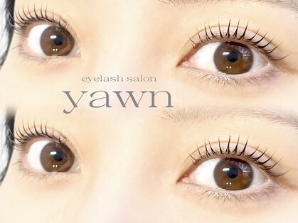 ヨウン(yawn)の写真
