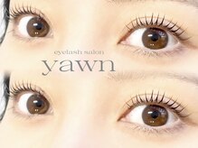 ヨウン(yawn)