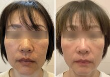 東京美容整体グループ 岡山脊椎矯正院 豊橋駅ビル院