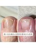 【巻き爪・足の爪悩み】プロが状態チェック！相談30分/￥3300→￥0