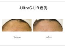 アンドエピ(&epi)/韓国痩身フェイシャル症例写真７