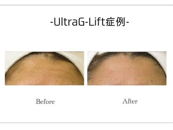 アンドエピ(&epi)/韓国痩身フェイシャル症例写真７