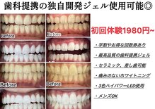 ホワイトニングスタイル 柏店