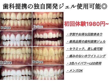 ホワイトニングスタイル 柏店