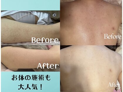 リリベル(LilyBell)の写真