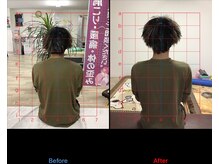 ストレチックス 近江八幡店/首・肩・腰に痛みがあった男性