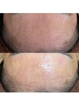 ソワ 吉塚店(soi)/敏感肌でも変われます☆