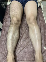 サロン チーク(Salon Cheek)/メンズ脱毛