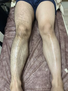 サロン チーク(Salon Cheek)/メンズ脱毛