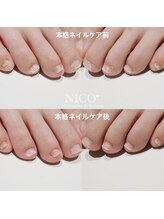 ニコプラス(NICO+)/足のお手入れできていますか？