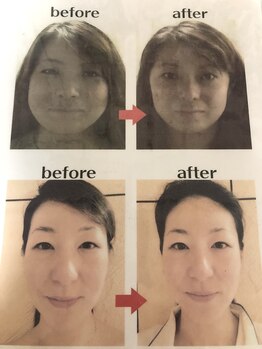 美容整体サロン オオカンシャ(okansha)/ソフトな施術で小顔に