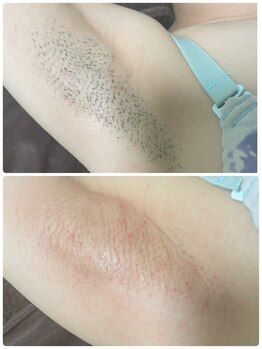 エン(en.)/BeforeAfter写真33