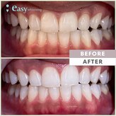イージーホワイトニング 五反田店(easy whitening)