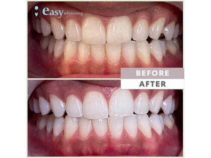 イージーホワイトニング 五反田店(easy whitening)の写真
