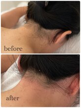 メンスエトマヌス(Mens et Manus)/うなじ シュガーリング脱毛