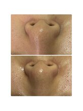 プリオール 太田店(Prior)/フェイシャルWAX