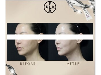 エミア(Emia)/韓国発☆プラチナ・プラピール