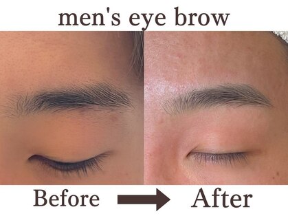 ミニョン(mignon)の写真